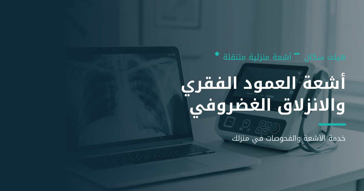 الأشعة المنزلية للعمود الفقري وتشخيص الانزلاق الغضروفي وآلام الظهر