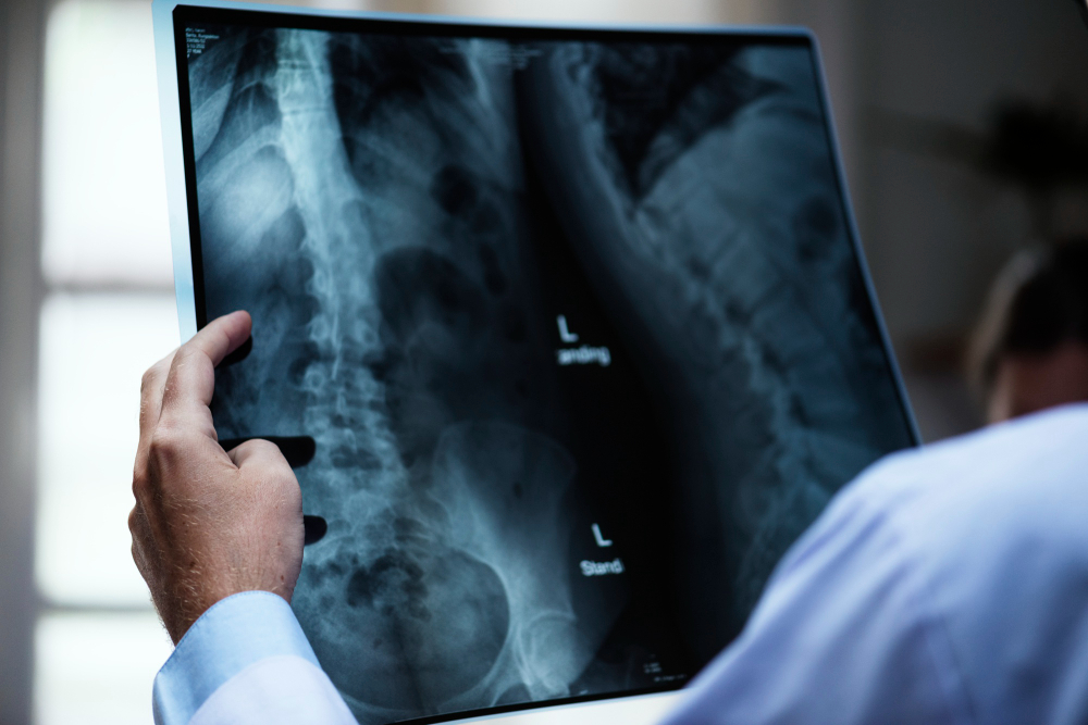 اشعة x-ray اشعة x-ray في المنزل